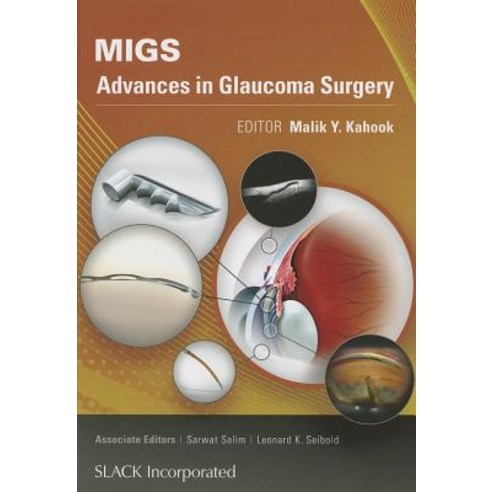 Migs: Advances in Glaucoma Surgery Paperback, Slack