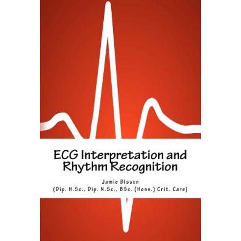 ECG Interpretation and Rhythm Recognition Paperback, Createspace Independent Publishing Platform