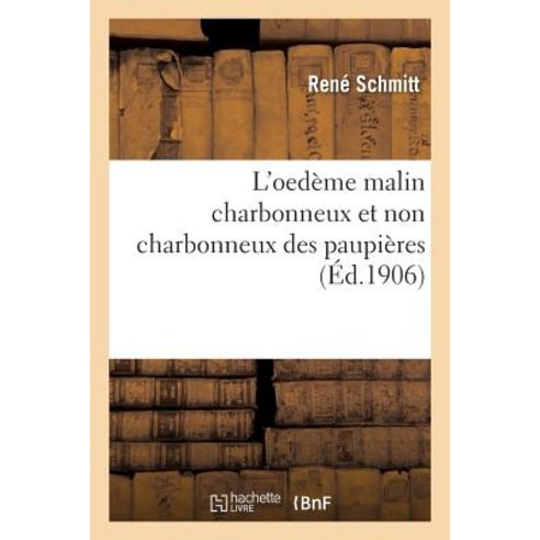 L''Oedeme Malin Charbonneux Et Non Charbonneux Des Paupieres = L''Oeda]me Malin Charbonneux Et Non Charb..., Hachette Livre Bnf