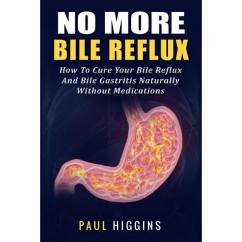 No More Bile Reflux: How to Cure Your Bile Reflux and Bile Gastritis Naturally Without Medications, Createspace Independent Publishing Platform