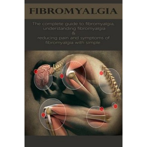 Fibromyalgia: The Complete Guide to Fibromyalgia Understanding ...