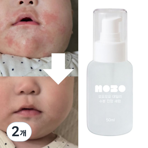 모요모요 침독크림 아기태열 초등학생앰플 고학년 사춘기 여드름화장품, 2개, 50ml
