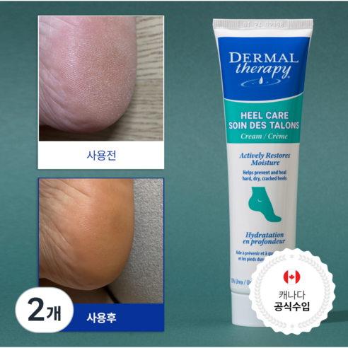 캐나다 더말테라피 데일리 고보습케어 각질제거 우레아 10% 풋크림, 90g, 2개, 1개입