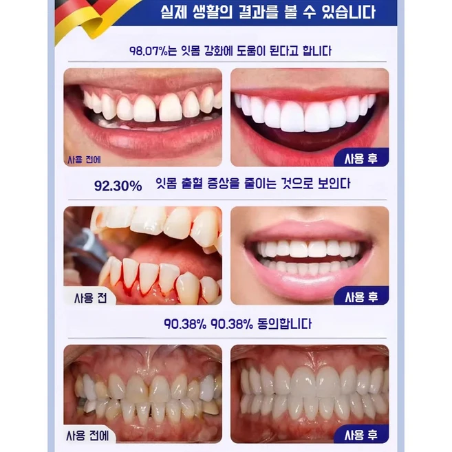 독일 개발 1+1 미백 치약 입냄새 제거 및 잇몸 케어 베이킹소다 효소 화이트닝 치약 선물 랜덤 증정, 110g, 2개