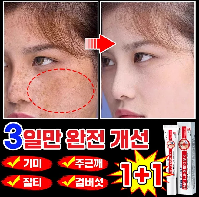 [당일발송] 1/1+1/2+2 기미크림 잡티 주근깨 검버섯 제거 미백 크림 멜라토닝 멜라논 크림 들깨기미크림 화이트닝 색소침착, 2개, 20.1g
