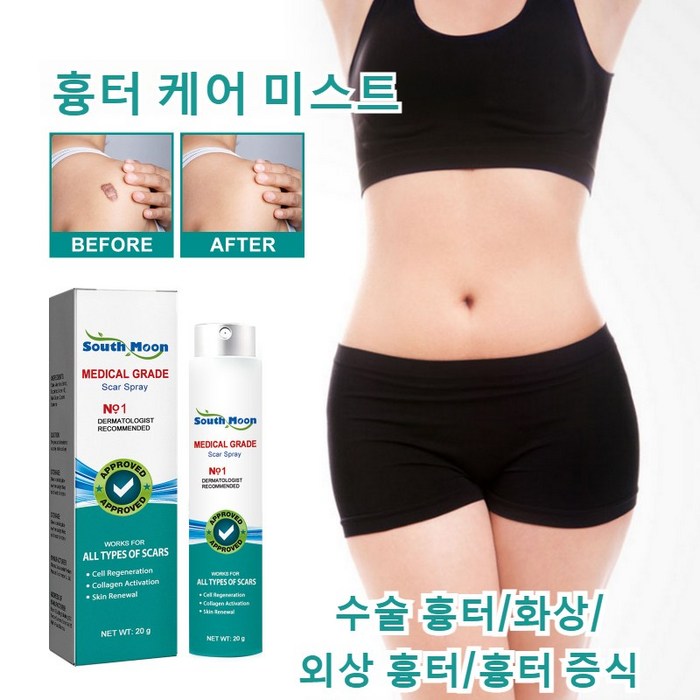 흉터 케어 미스트 수술흉터 화상물집 쌍꺼풀흉터 제왕절개흉터 흉터제거연고 재생크림 과민성 흉터/흉터 증식