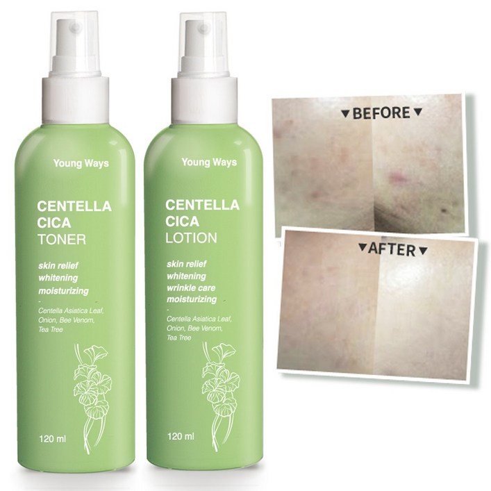 영웨이즈 시카 토너 120ml  로션 120ml 세트  티트리  병풀  봉독  어성초 여드름