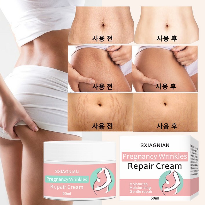 (한국셀러/본토출하)임산부 산전후 튼살 탄력케어 크림 흉터관리 임산부 청소년 이용가능, 2개, 50g
