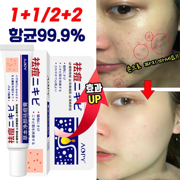 일본 1122 여드름 흉터 제거 연고 피부 색소침착 미백 크림
