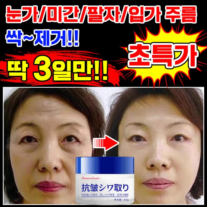 100 제거 일본 11122 주름개선 크림 재생크림 눈가 미간 팔자 주름 제거 크림 레티놀 탄력 미백 수분크림 리프팅 모공 수축