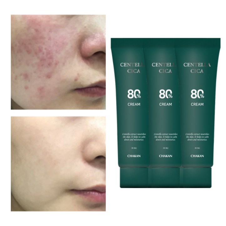 트러블 진정 모공 각질 피지케어 센텔라80 시카크림, 50ml, 3개
