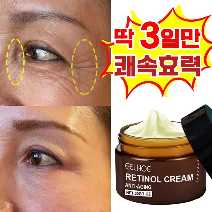 빠른배송 주름 개선 재생 레티놀 크림 모공수축 팔자 목 눈밑 주름 크림 탄력 영양 미간 눈가 수분크림 빠른배송 주름 개선 재생 레티놀 크림 모공수축 팔자 목 눈밑 주름 크림 탄력 영양 미간 눈가 수분크림